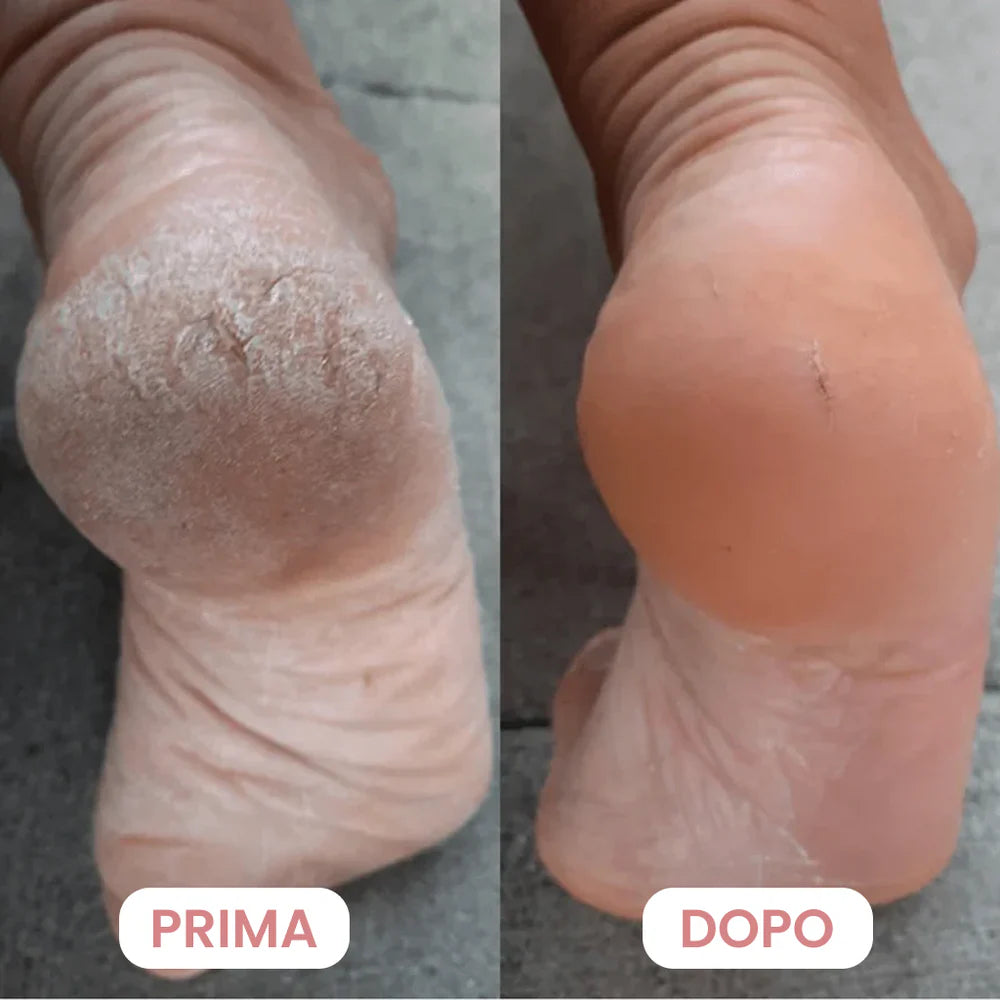 Lima Elettrica Piedi Professionale