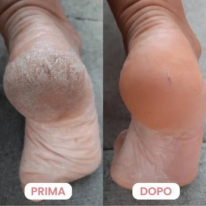 Lima Elettrica Piedi Professionale